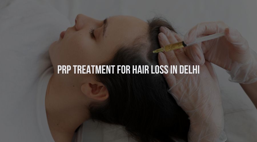 PRP Treatment for hair loss in Delhi