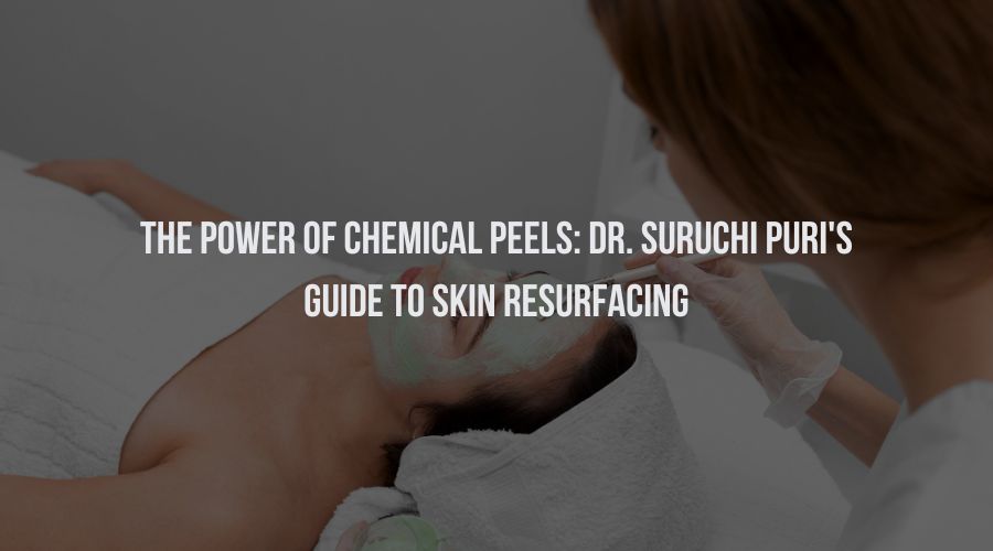 The Power of Chemical Peels: Dr. Suruchi Puri's Guide to Skin Resurfacing