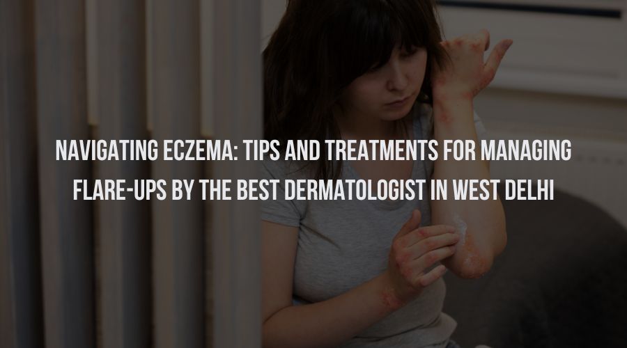 Navigating Eczema: Tips and Treatments for Managing Flare-Ups
