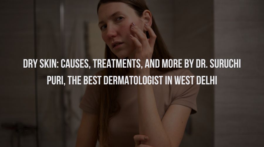 Dry Skin: Causes, Treatments, and More by Dr. Suruchi Puri, the Best Dermatologist in West Delhi