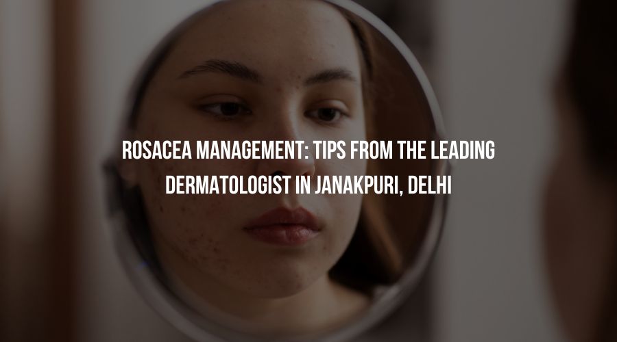 Rosacea Management: Tips from the Leading Dermatologist in Janakpuri, Delhi