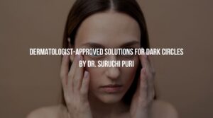 Dermatologist-Approved Solutions for Dark Circles by Dr. Suruchi Puri