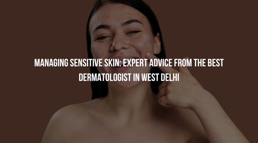 Managing Sensitive Skin: Expert Advice from the Best Dermatologist in West Delhi