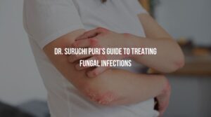 Dr. Suruchi Puri’s Guide to Treating Fungal Infections