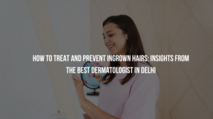 Skin doctor in delhi