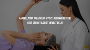 Xanthelasma Treatment Myths: Debunked by the Best Dermatologist in West Delhi