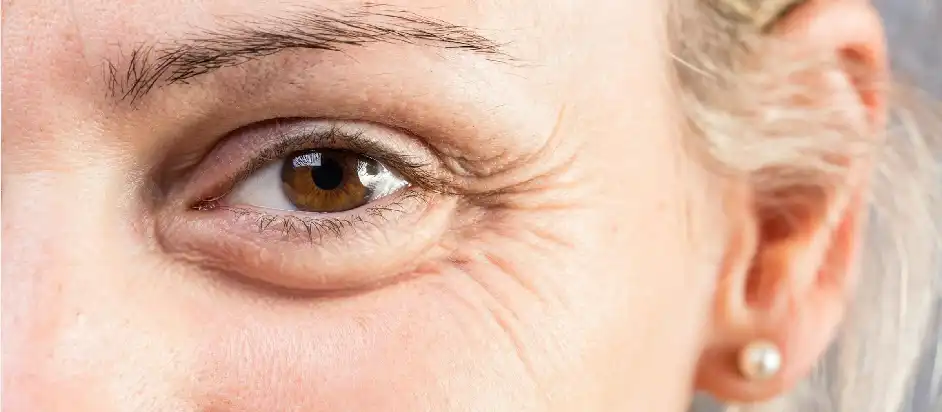 PRP Treatment in Delhi