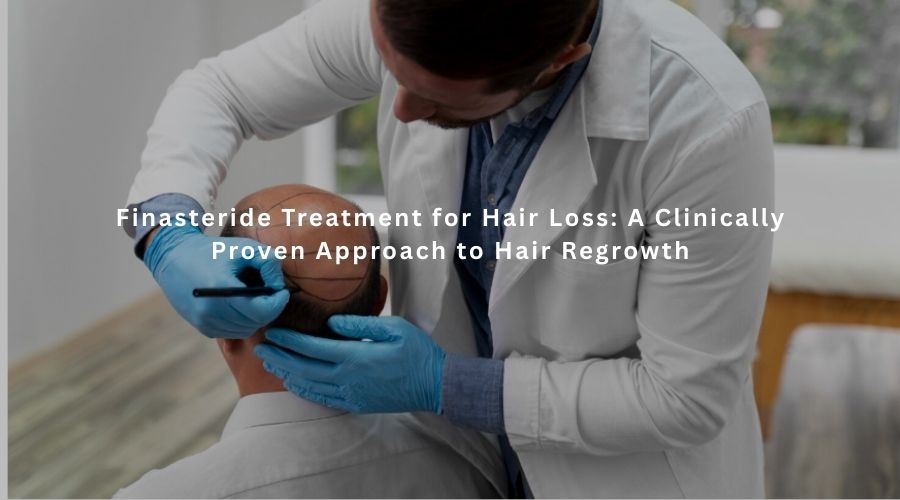 Finasteride Treatment for Hair Loss: A Clinically Proven Approach to Hair Regrowth