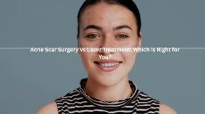 Woman with mild acne scars smiling – Acne Scar Surgery vs Laser Treatment comparison