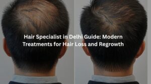 Hair Loss Treatment in Delhi by Dr Suruchi Puri