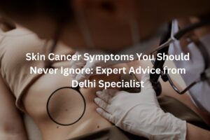 Early skin cancer symptoms and warning signs explained by a skin specialist
