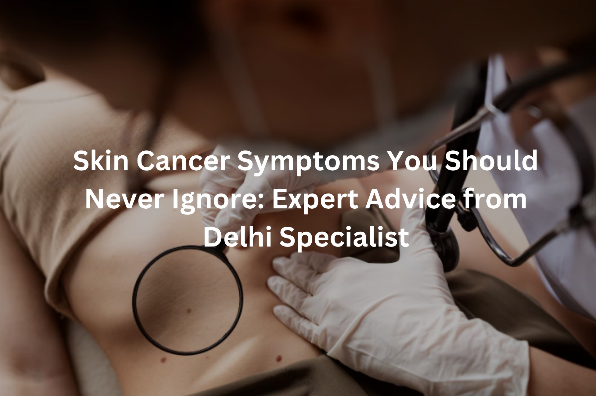 Skin Cancer Symptoms You Should Never Ignore: Expert Advice from Delhi Specialist