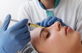 PRF Biofiller treatment for facial rejuvenation and natural collagen stimulation