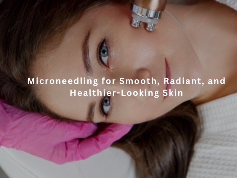 Microneedling for Smooth, Radiant, and Healthier-Looking Skin