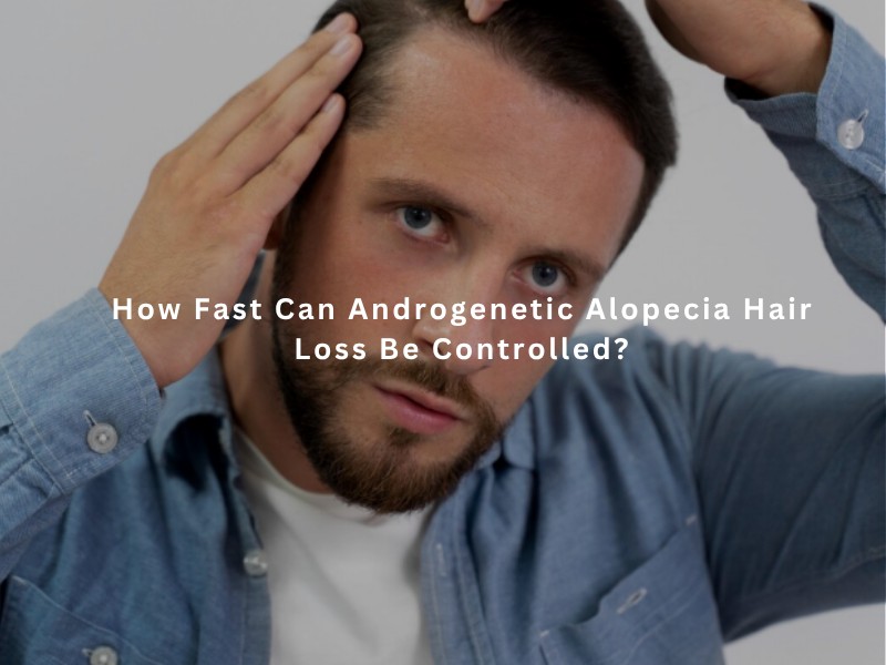 How Fast Can Androgenetic Alopecia Hair Loss Be Controlled?
