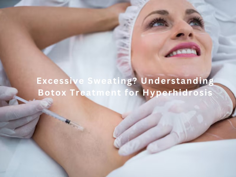 Excessive Sweating? Understanding Botox Treatment for Hyperhidrosis