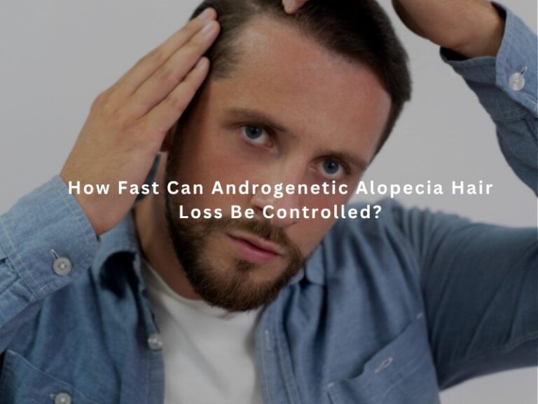How Fast Can Androgenetic Alopecia Hair Loss Be Controlled?