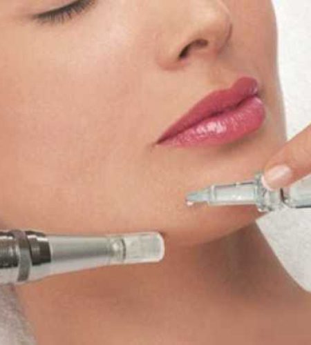 Mesotherapy in delhi